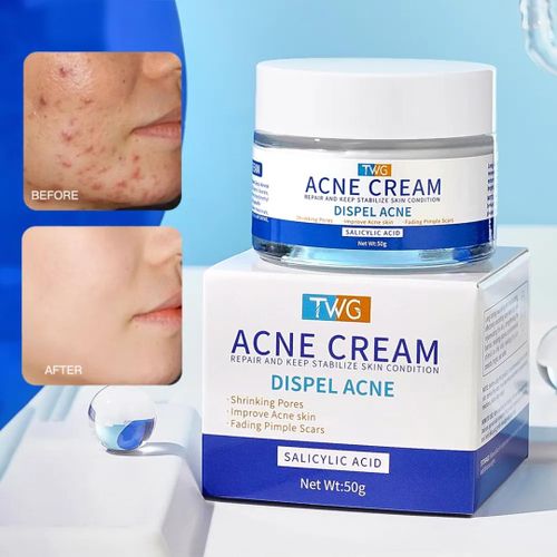 TWG Pimples Treatment cream